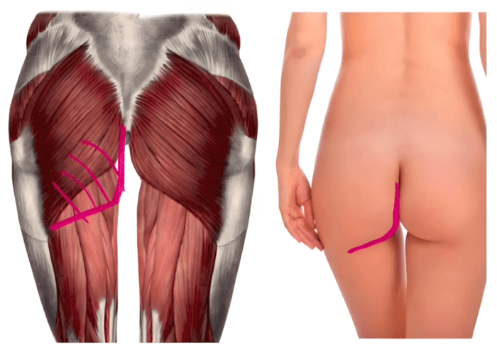 posterior gluteal fat pad and gluteal crease butt anatomy muscles and fat by anatomy for sculptors