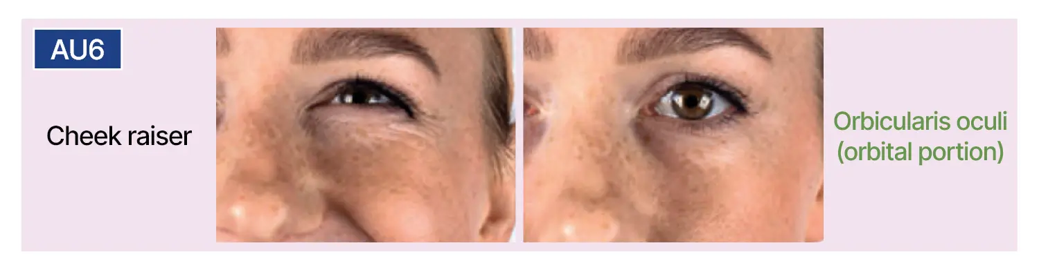 AU6-Levantamento de bochechas